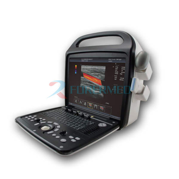COLOr doppler COLOr doppler
