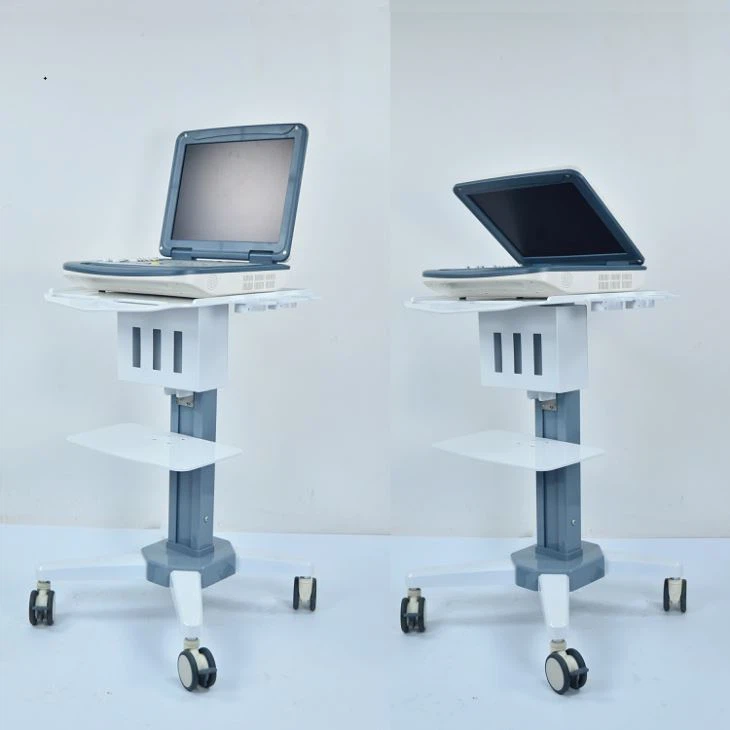 Digitale draagbare echografiesysteemscanner in kleur