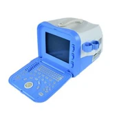 2D Z/W draagbare echografie-diagnosemachine