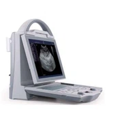 Z / W-systeem digitale draagbare ultrasone scanner