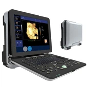 High-end draagbare kleurendoppler-echografie vergelijkbaar met Mindary