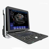 Laptop Ultrasoon Diagnostisch Systeem