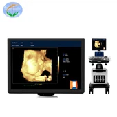 Goede verkoop 4D Color Doppler-echografiescanner