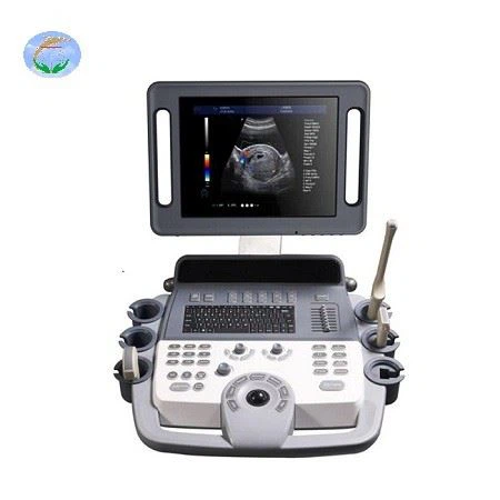 4D Color Doppler Ultrasound Diagnostic System 4D Color Doppler Ultrasound Diagnostic System
