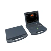 Laptop kleuren-echografiemachine