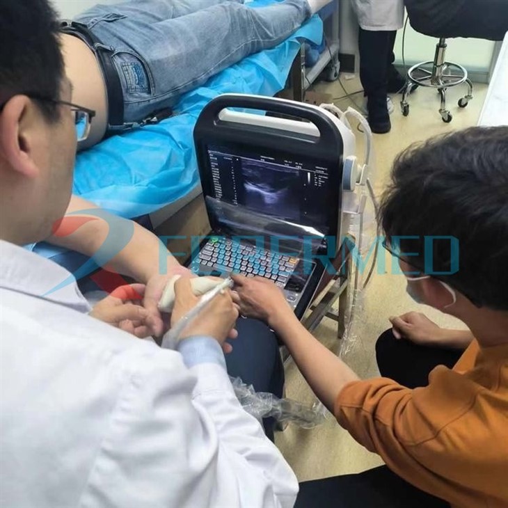 4d Colour Doppler Ultrasound 4d Colour Doppler Ultrasound