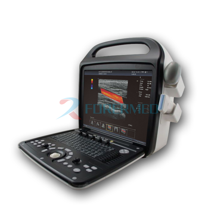 4D-kleurendoppler-echografie